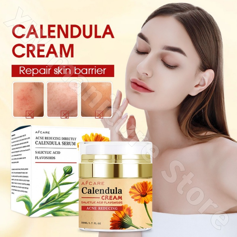 Luxury Skincare Whitening Cream - Repairing Calendula Cream Moisturizing และ Rejuvenating